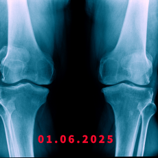 Auf die Knie? Auf die Knie?